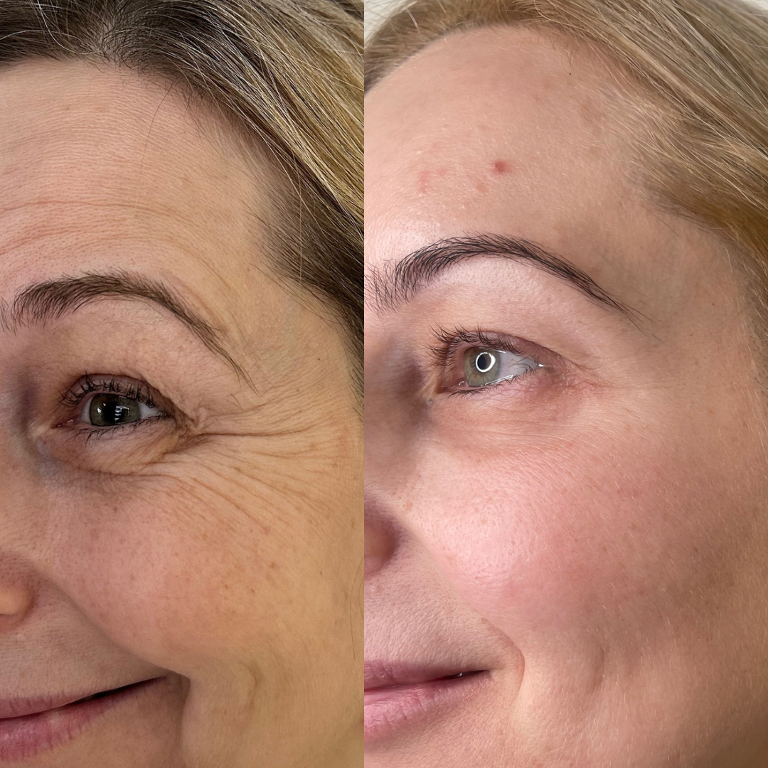 Pure+Seoul+Aesthetics+_+Medspa+in+West+Bloomfield+Township,+MI+48009